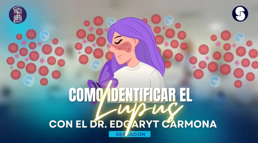 Como identificar el lupues